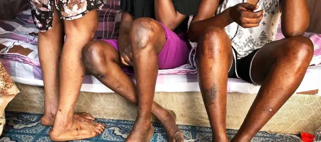 Sexual Workers in Uganda