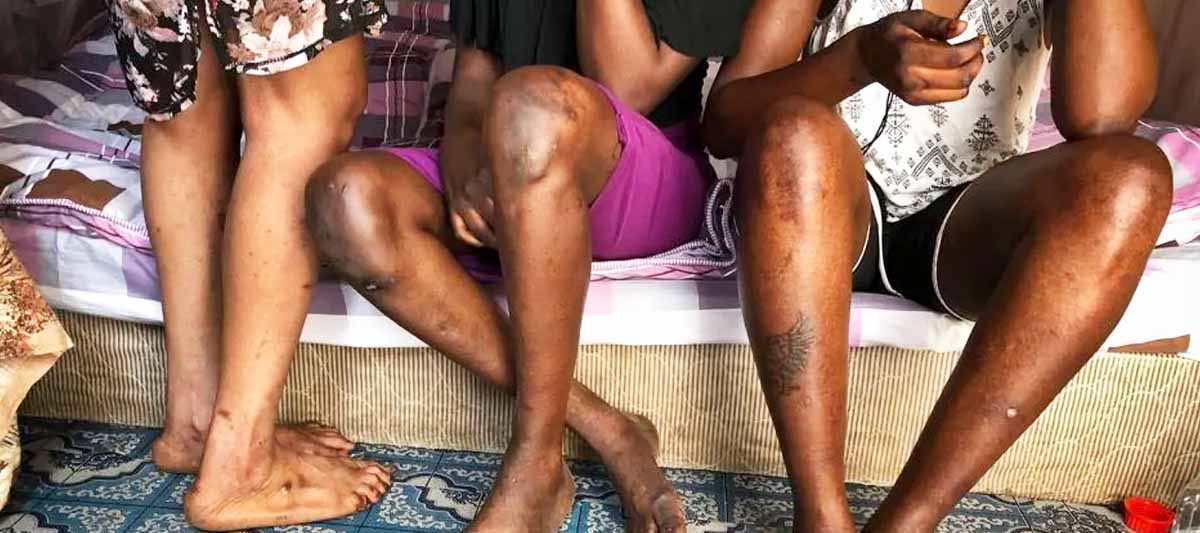 Breaking the Cycle: Supporting Sex Workers in Eastern Uganda